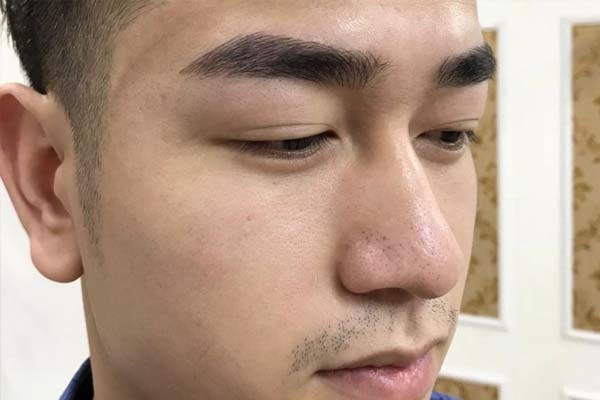 điêu khắc chân mày cho nam tại thẩm mỹ winston