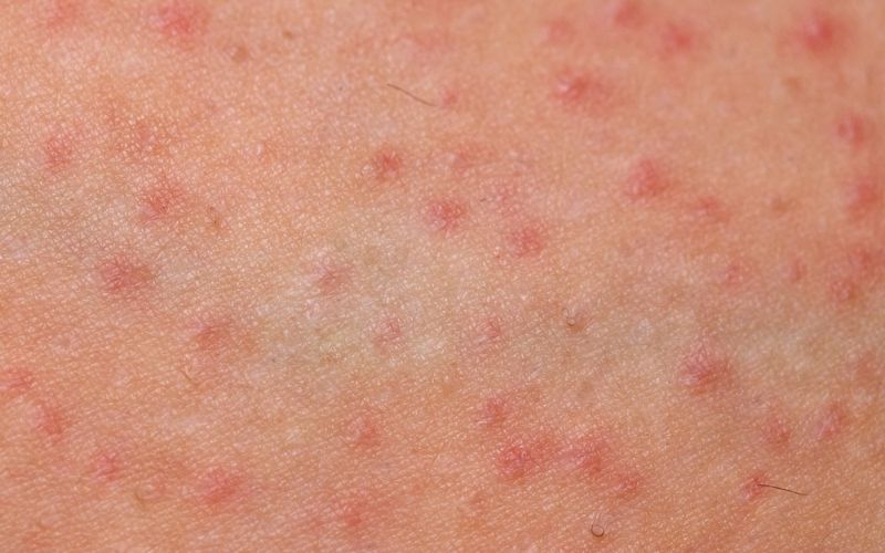 Viện Thẩm mỹ Winston sở hữu hệ thống trang thiết bị hiện đại