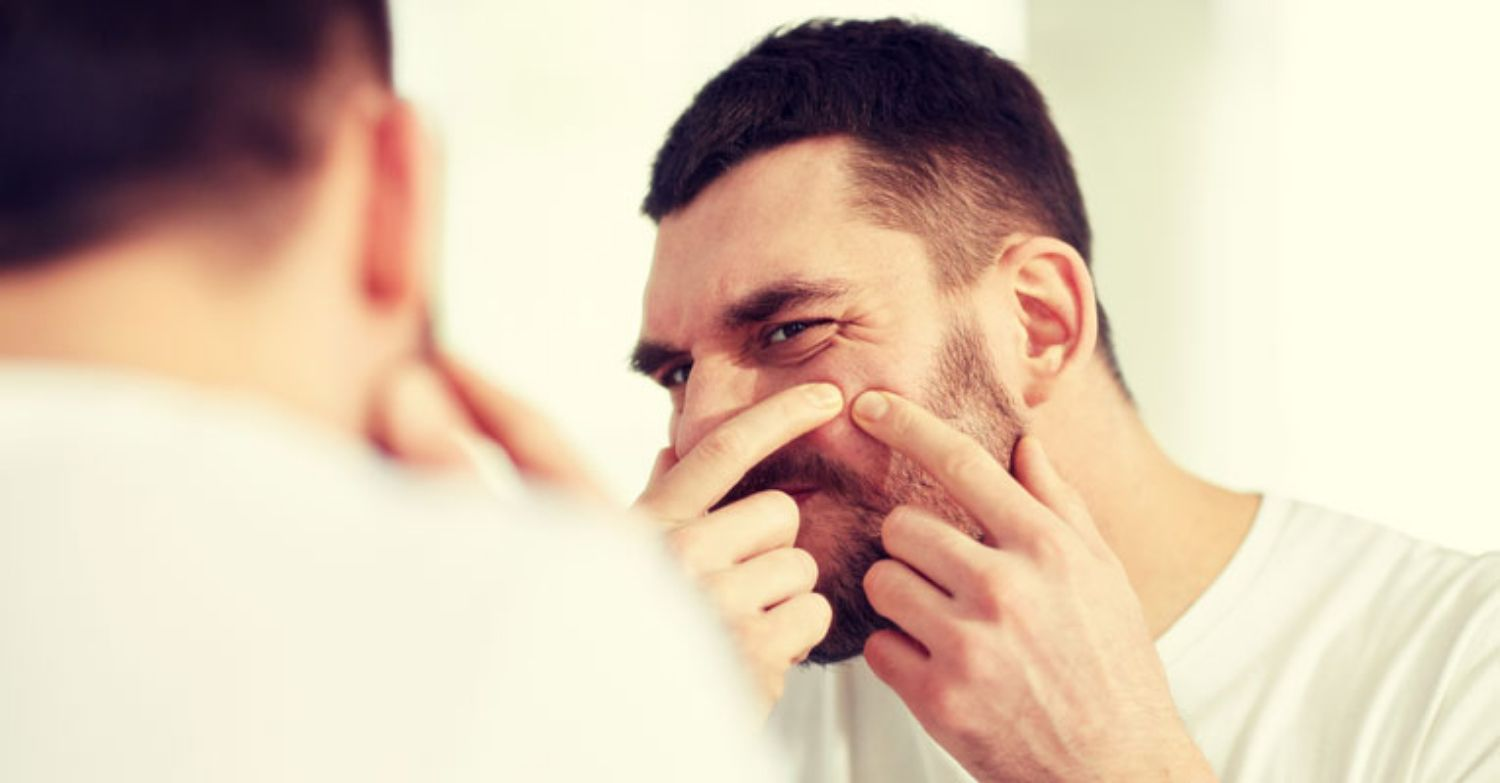 Điều trị mụn cho nam giúp tiết kiệm thời gian và chi phí 