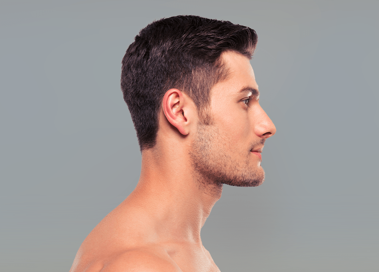 Một ví dụ cho sống mũi đẹp và nam tính đem lại vẻ ngoài quyến rũ