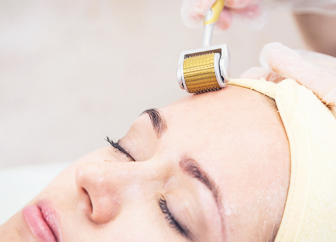 Mài da vi điểm được ứng dụng rộng rãi trong điều trị sẹo rỗ cho nam lẫn nữ