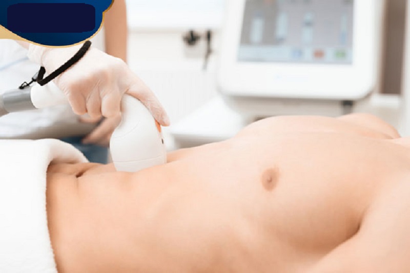 Triệt lông vùng kín nam có đau không? 