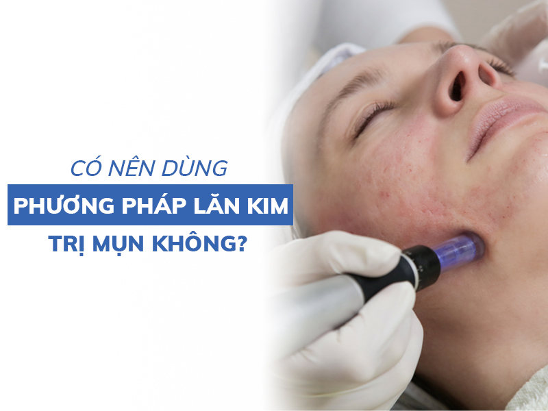 Lăn kim cho nam có cần thiết hay không? 