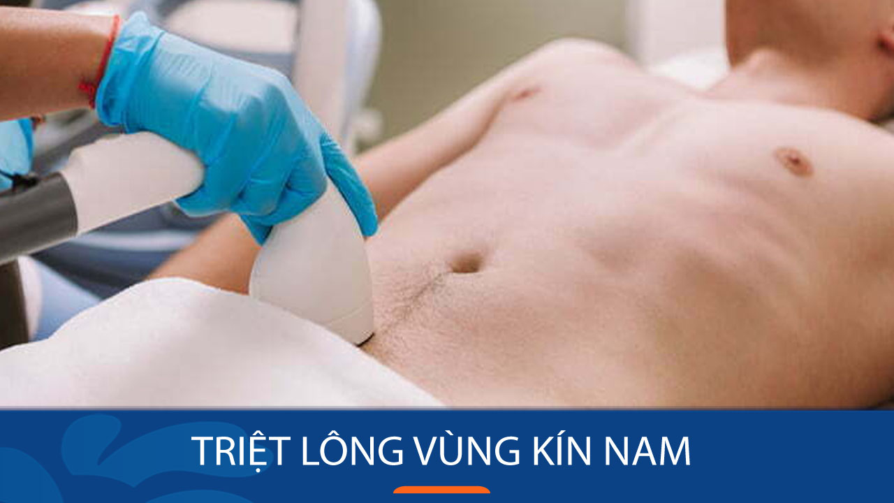 Có nên triệt lông vùng kín nam không? Triệt lông đau không?