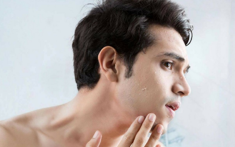 Trị mụn bằng đá lạnh và nước vo gạo