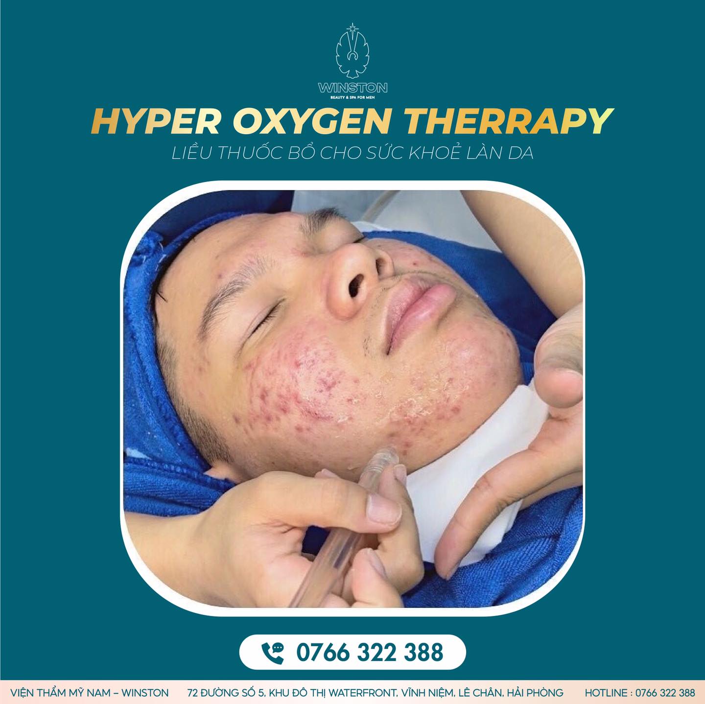 Trị mụn dị ứng liên hệ Viện Thẩm Mỹ Nam Winston Hải Phòng