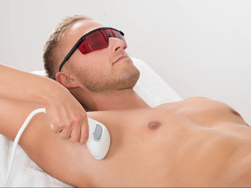 Triệt lông nách có hết hôi nách không sẽ được bật mí dưới đây