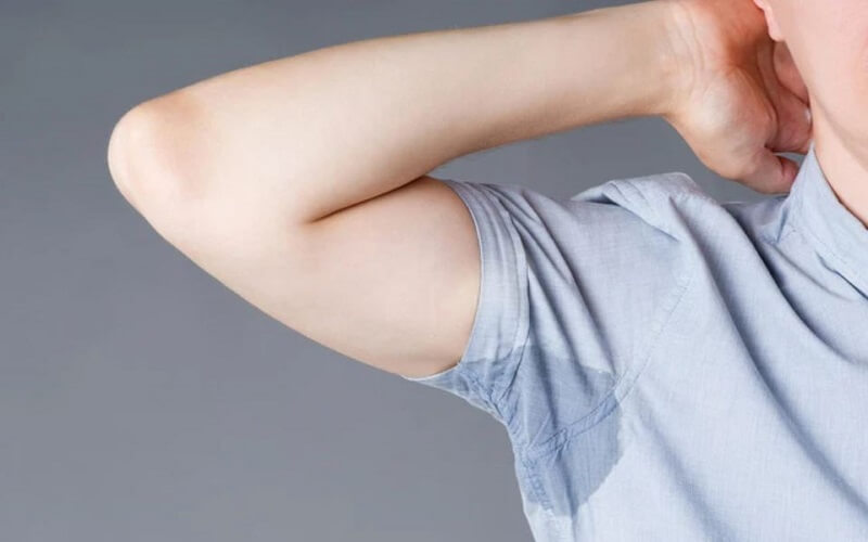 Cắt tuyến mồ hôi nách giảm lượng mồ hôi tiết ra