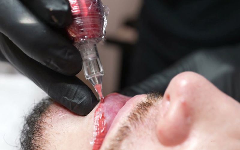 Thẩm mỹ Nam Winston nhận phun môi nam giới uy tín