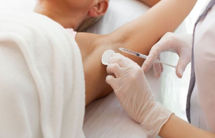 Trị hôi nách dứt điểm cho nam giới bằng tiêm botox