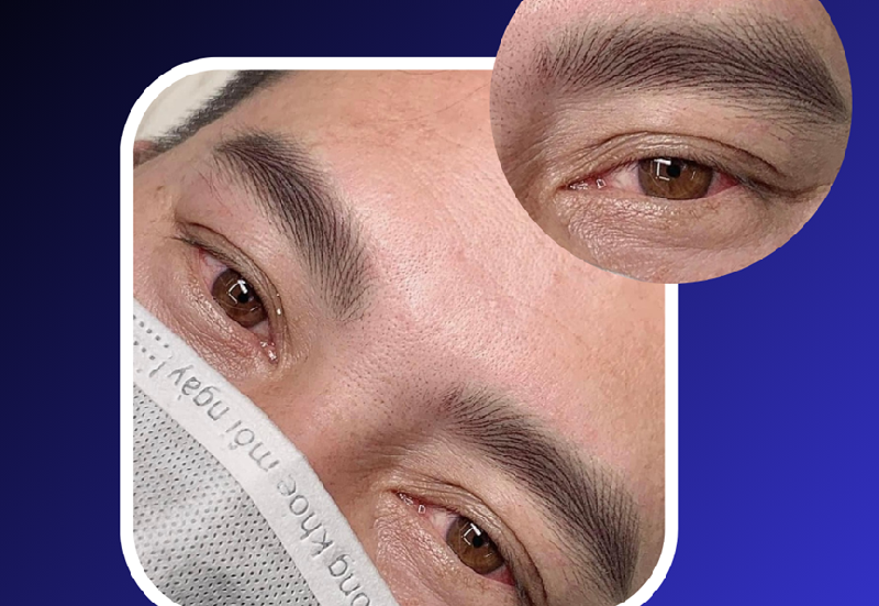 Điêu khắc chân mày nam giúp tăng tính thẩm mỹ