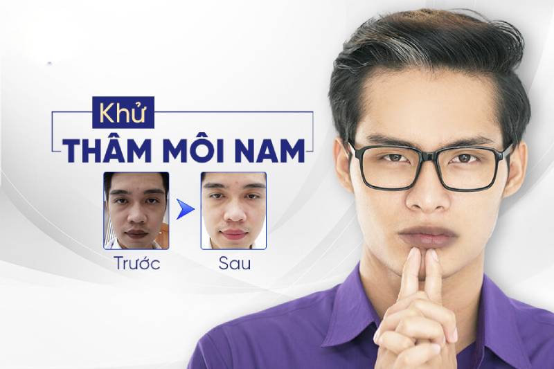 Nam giới nên điều trị thâm môi để cải thiện ngoại hình của mình