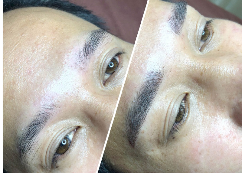 Có thể chọn xóa mày hỏng bằng kem chuyên dụng