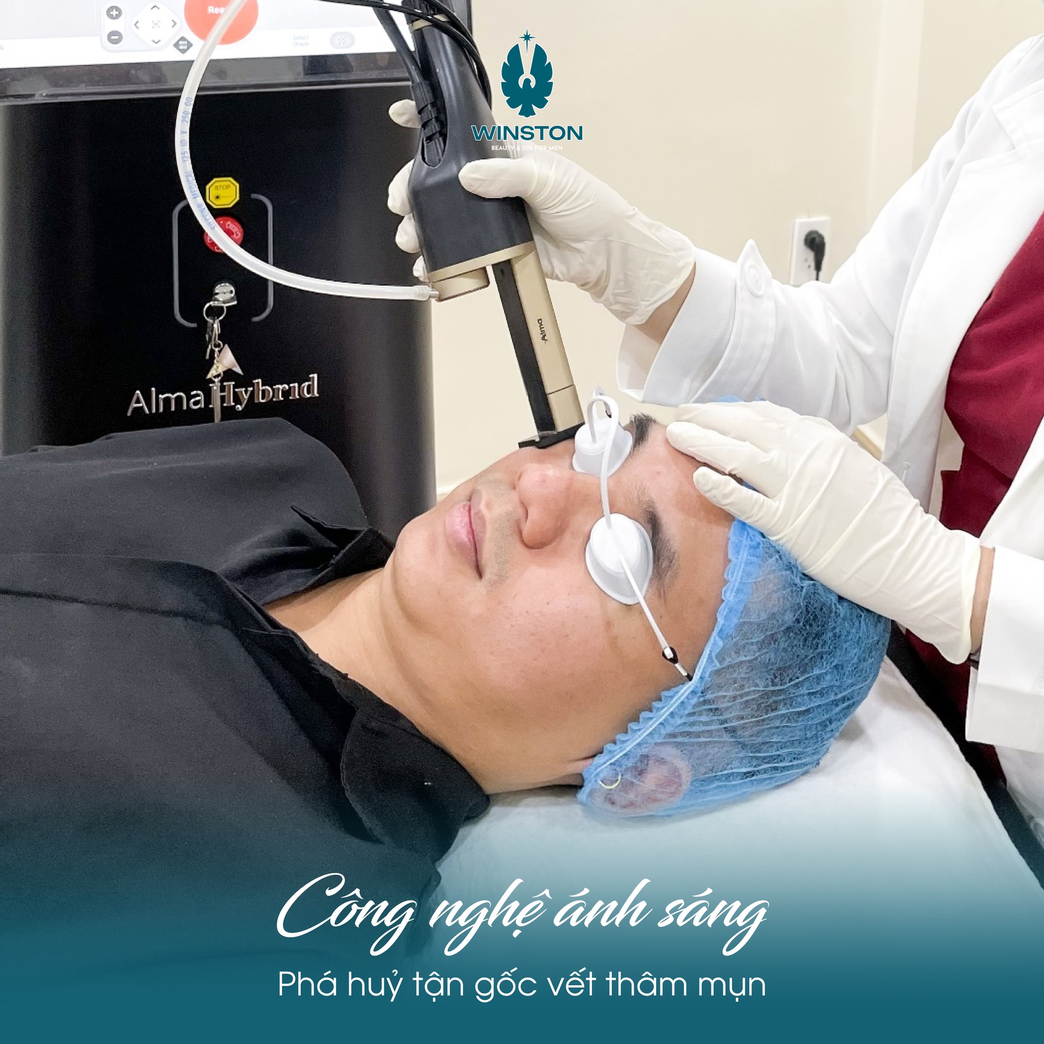 Khách hàng điều trị mụn bằng công nghệ Laser CO2 cho nam giới tại Hải Phòng, da sáng mịn rõ rệt sau liệu trình.