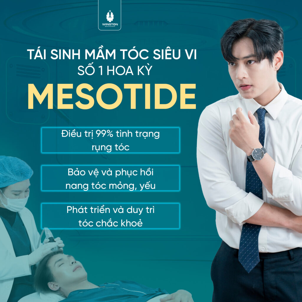 Trị hói đầu cho nam giới tại Hải Phòng